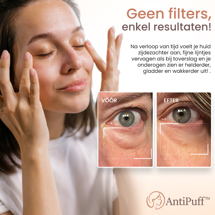 AntiPuff™ Oogserum