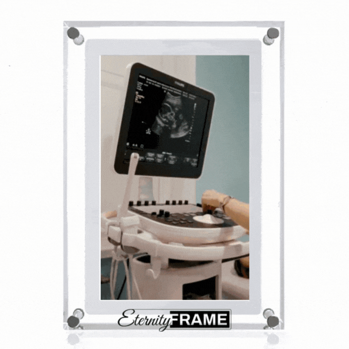 EternityFrame™ Digital Frame