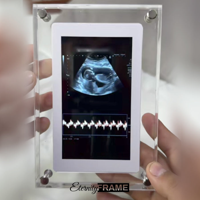 EternityFrame™ Digital Frame