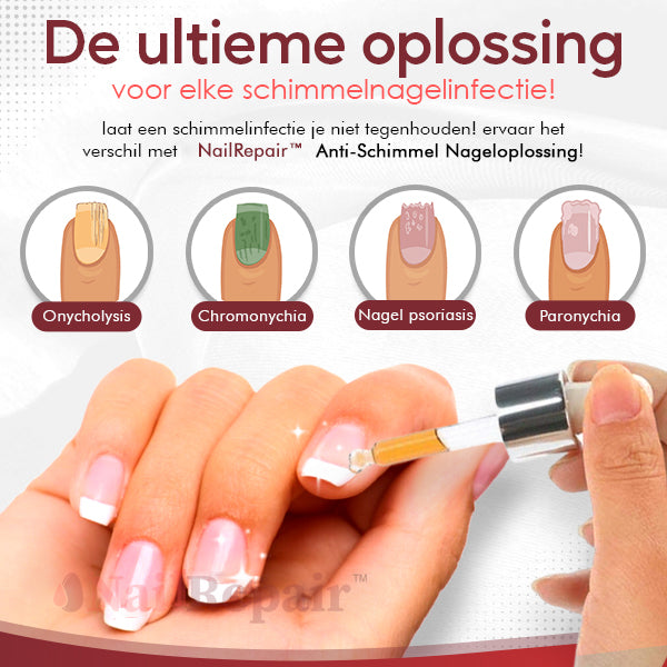 NailRepair™ Antischimmel Nageloplossing