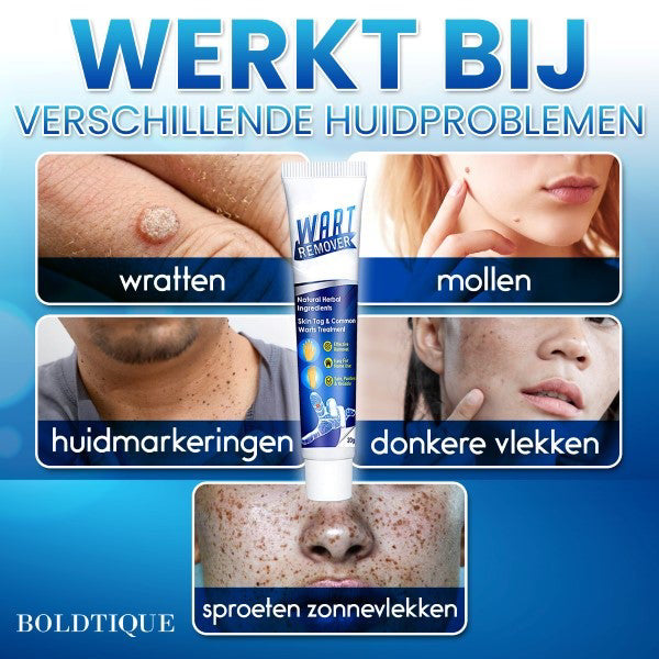 Boldtique™ Crème Tegen Wratten