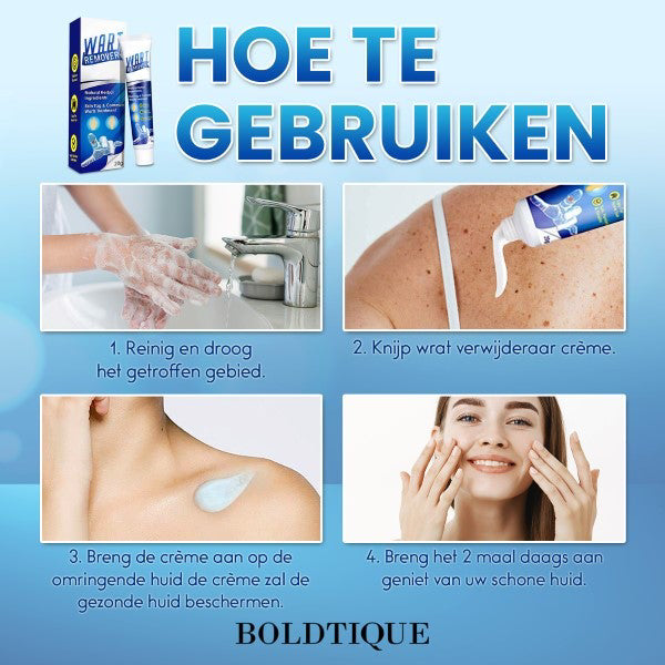 Boldtique™ Crème Tegen Wratten