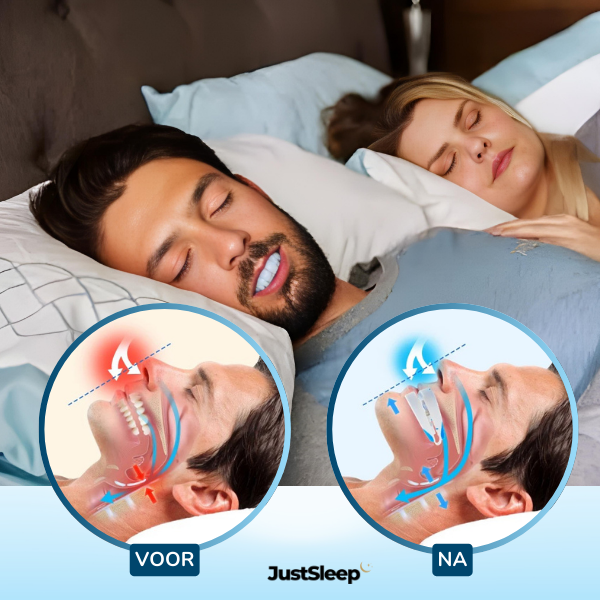 JustSleep Mouth Guard