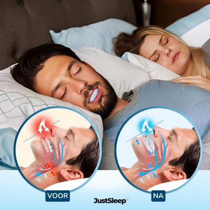 JustSleep Mouth Guard