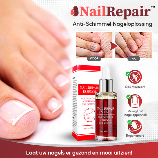 NailRepair™ Antischimmel Nageloplossing